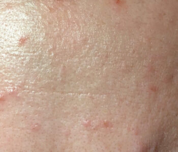 00BC03B1-DA18-4E26-A69C-3D55FAF0EF41