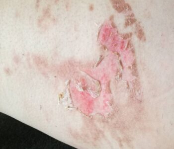 19059202_1397295300352103_7054015416630284711_n-1