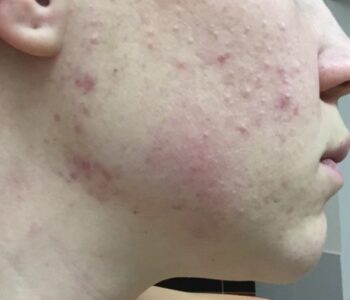 AE9B2AD5-F7AF-4866-AD7C-80DDC1759B58